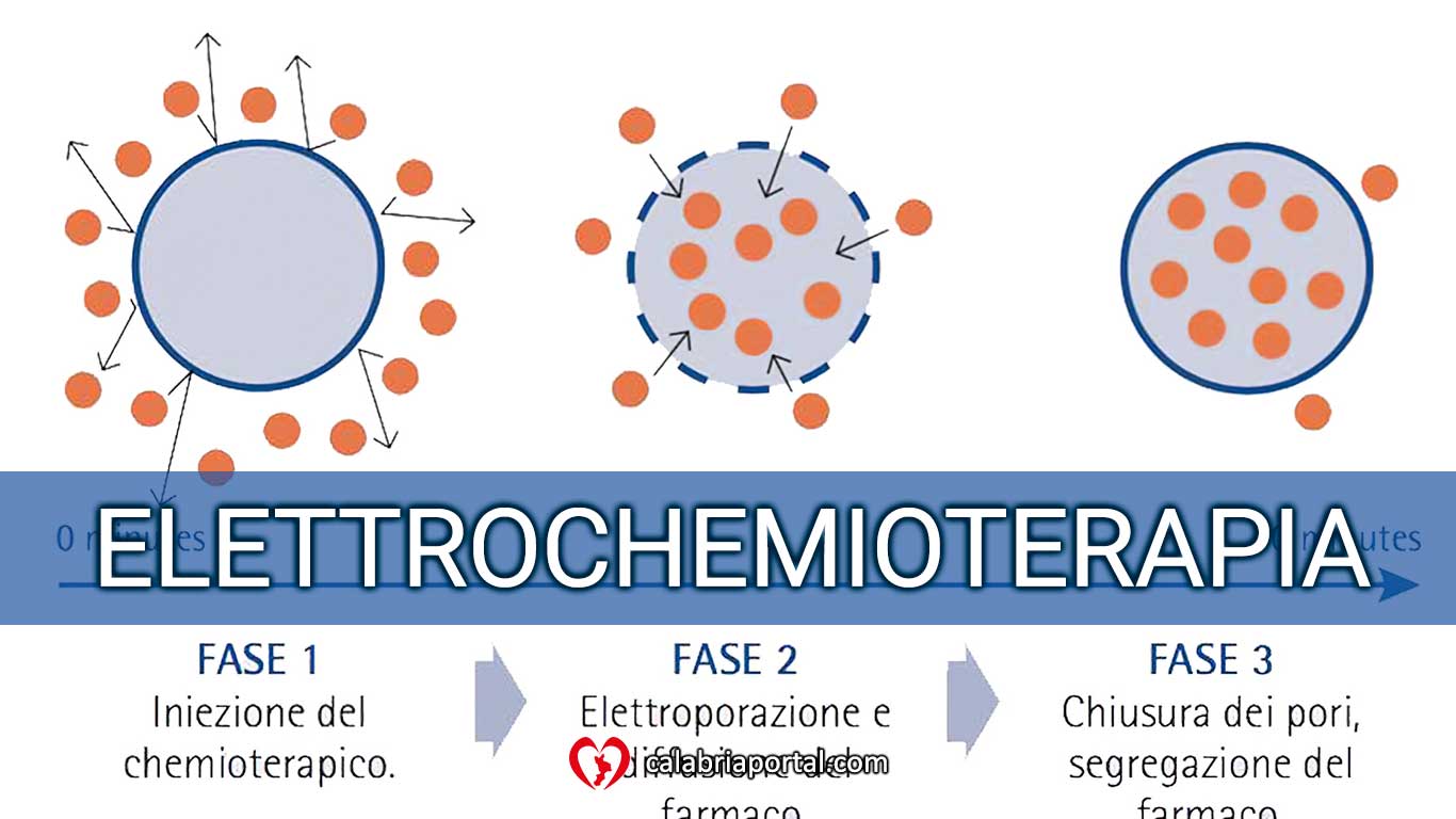 Elettrochemioterapia - Clinica Veterinaria San Giorgio (RC) Elettrochemioterapia - Clinica Veterinaria San Giorgio (RC)