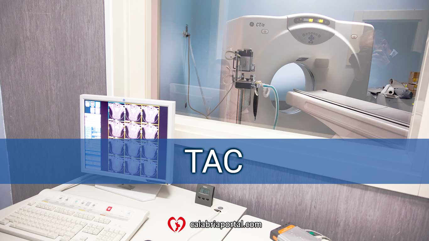 TAC - Clinica Veterinaria San Giorgio (RC) TAC - Clinica Veterinaria San Giorgio (RC)
